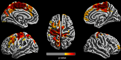 An image showing which brain regions are most affected by air pollution.